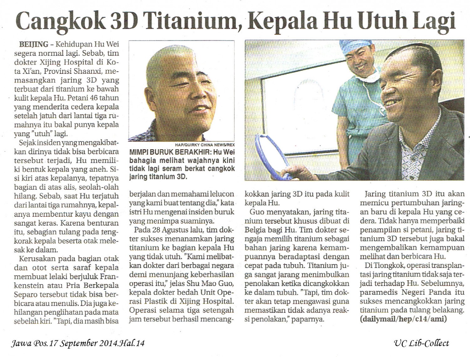 Cangkok 3D Titanium, Kepala Hu Utuh Lagi. Jawa Pos.17 September 2014.Hal.14